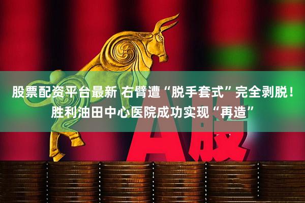 股票配资平台最新 右臂遭“脱手套式”完全剥脱！胜利油田中心医院成功实现“再造”